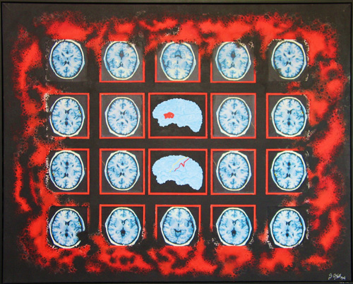 Brain Scan